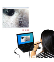 2-in-1 USB Ear Cleaning Endoscope HD Visual Ear Spoon Multifunctional Earpick